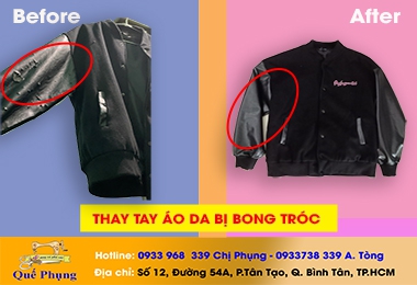 THAY ÁO DA BỊ BONG TRÓC